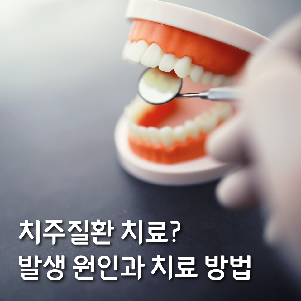 치주질환치료? 발생 원인과 예방 및 치료 방법을 알아보자 관련 이미지 1
