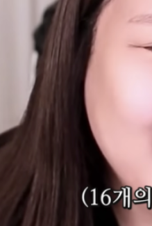 풍자 라미네이트? 치아 삭제 없는 과정으로 관련 이미지 1