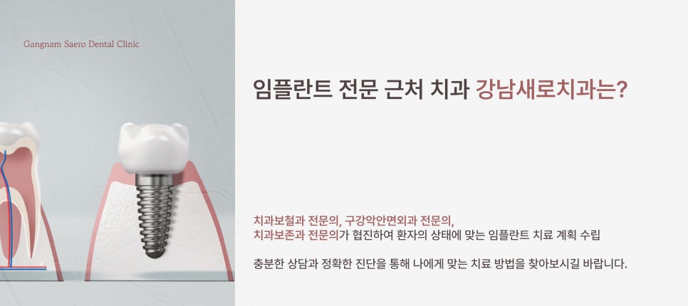 임플란트 잘하는 치과 기준 (임플란트전문 근처치과 강남새로치과) 관련 이미지 6