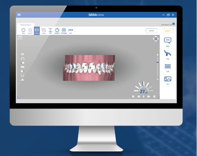 투명교정종류 자세히 알아보기 (4) 세라핀 관련 이미지 3