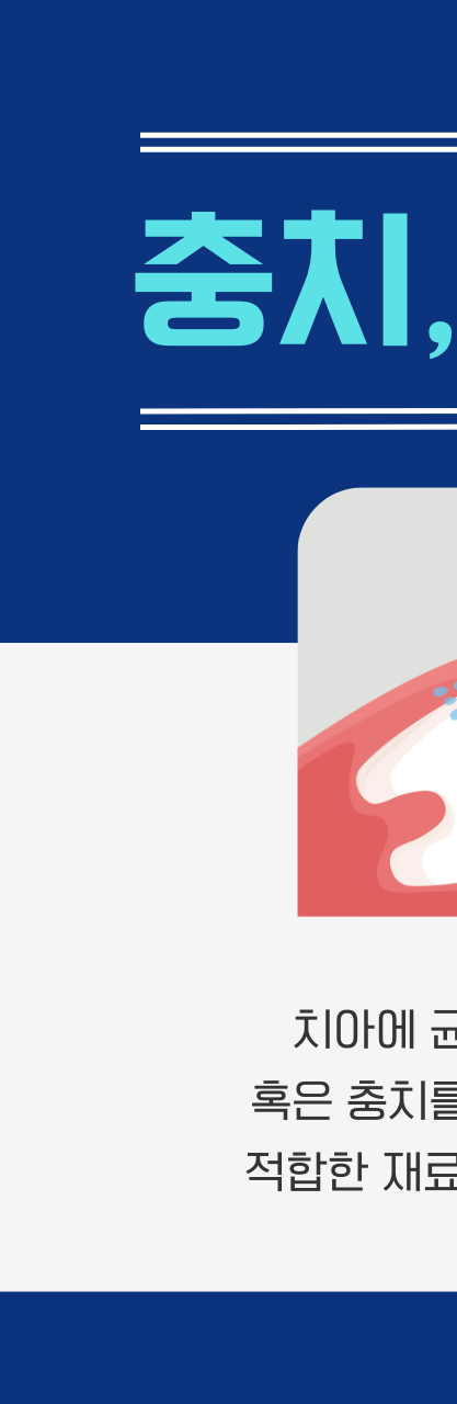 강남역 충치치료, 치아의 문제를 개선하는 과정? 관련 이미지 1