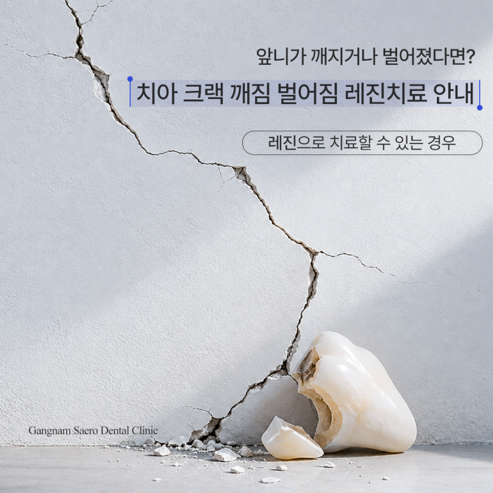 앞니가 깨지거나 벌어졌다면? 레진 치료 안내 관련 이미지 1