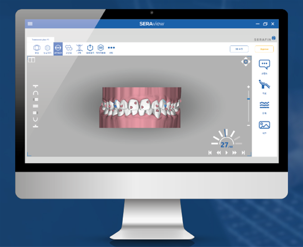 투명교정장치 다시 알아보기 (4) 세라핀 관련 이미지 2