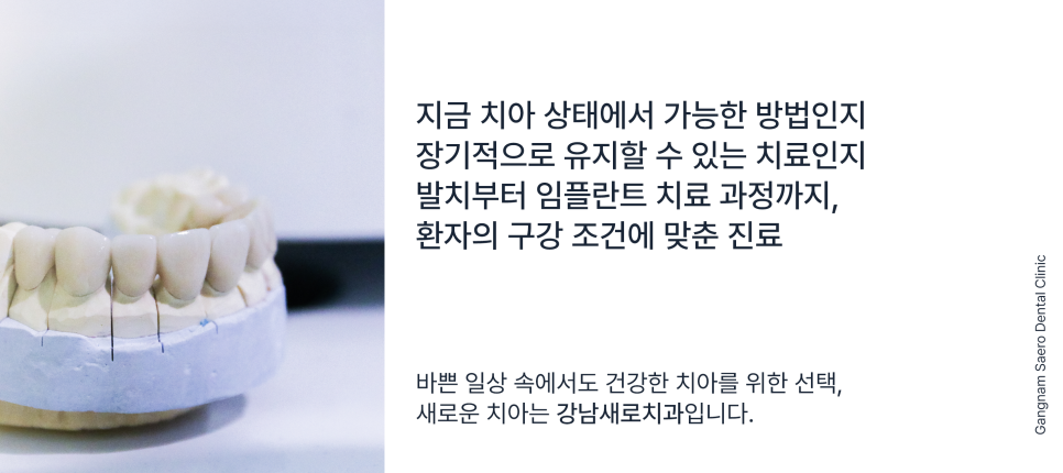 20대임플란트 30대임플란트, 임플란트기간 단축 하루임플란트 관련 이미지 8