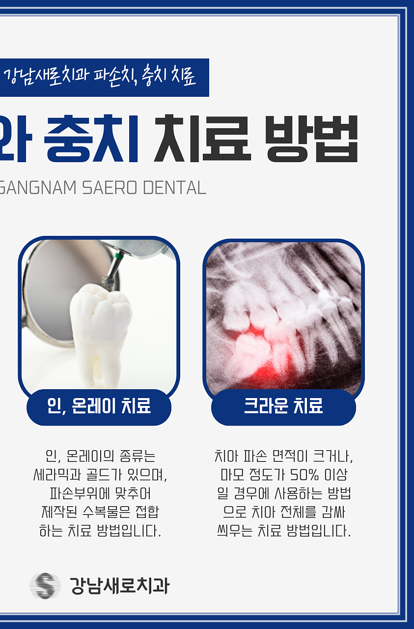 탕후루 치아 손상을 유발? 치료 방법 및 후기 관련 이미지 9