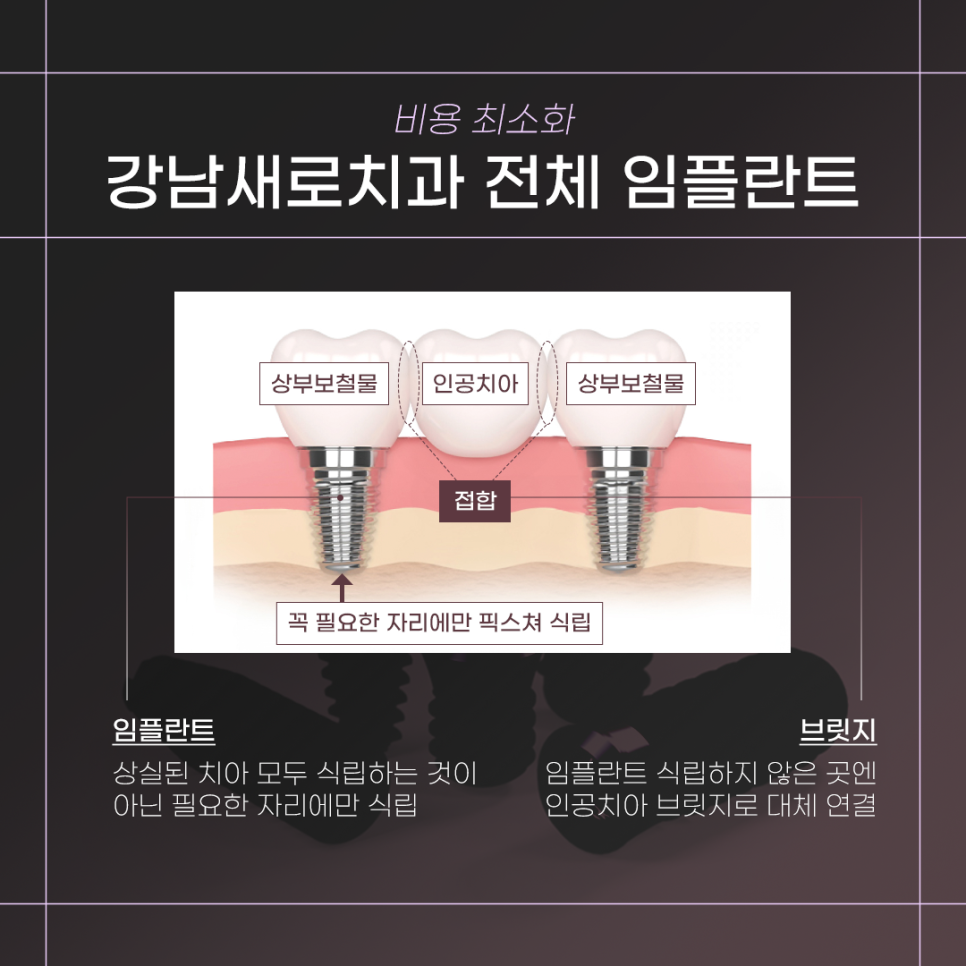 전체임플란트 건강보험적용 (65세이상임플란트) 관련 이미지 4