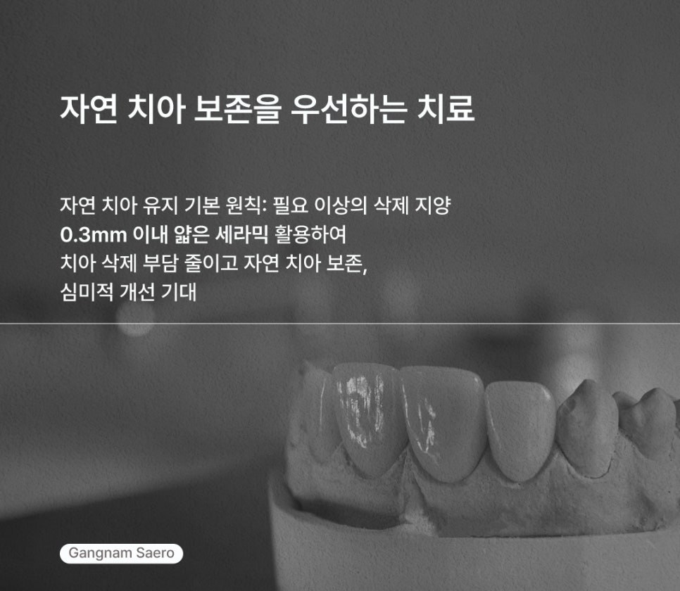 치아 삭제 부담을 줄인 심미 치료 (라미네이트대체 에어네이트) 관련 이미지 7
