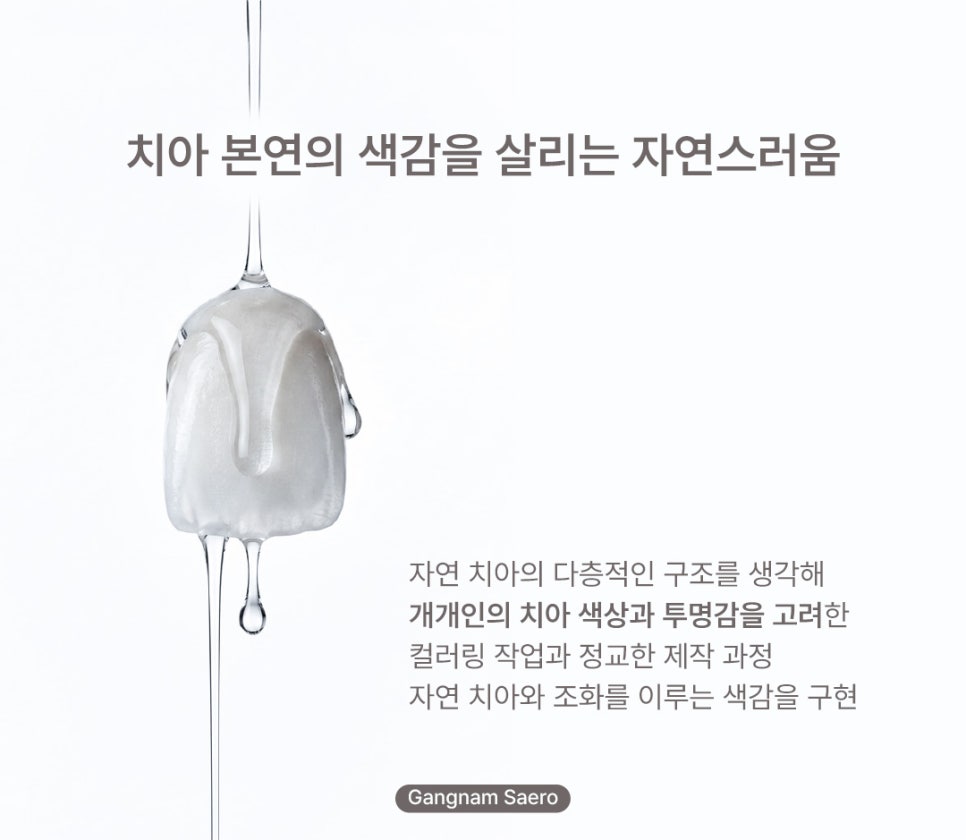 치아 삭제 부담을 줄인 심미 치료 (라미네이트대체 에어네이트) 관련 이미지 5