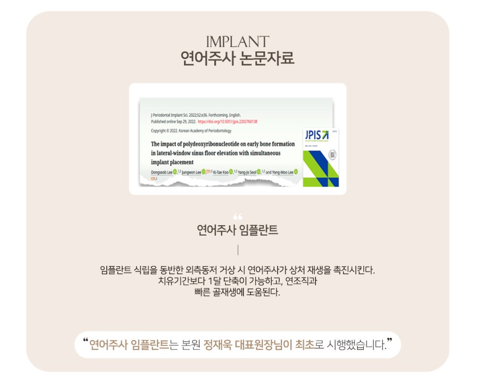 임플란트 성공률 수술 전 살펴봐야할 것 (임플란트주의사항) 관련 이미지 10