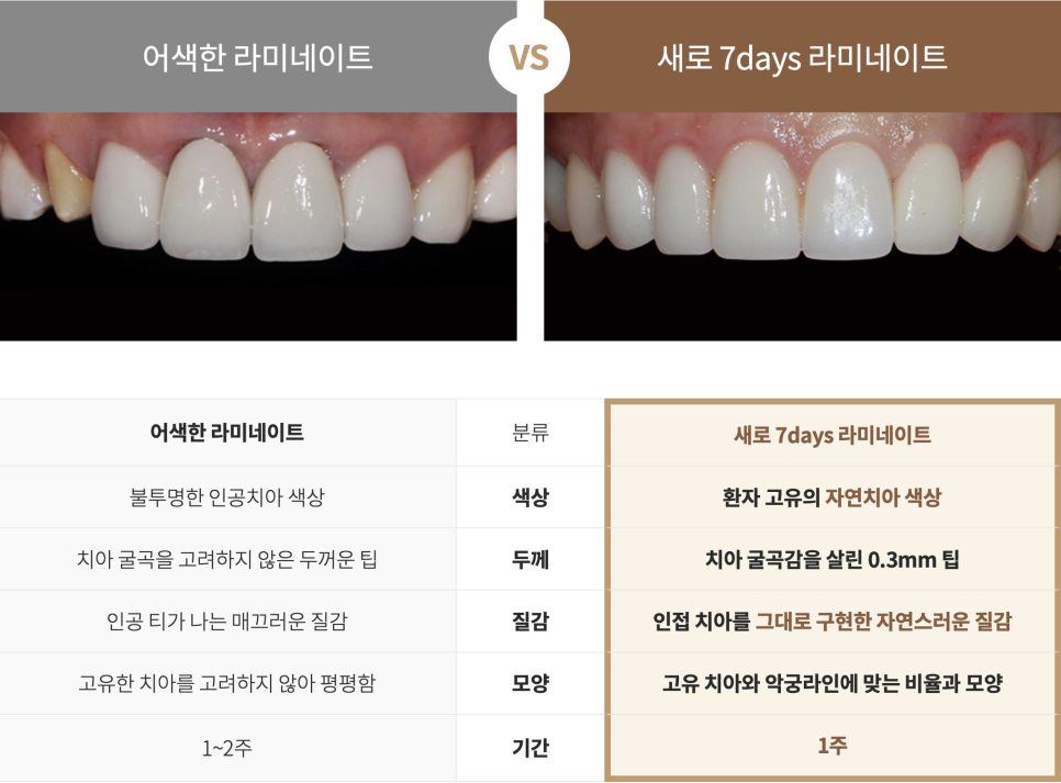 강남역라미네이트, 부작용을 최소화하는 방법? 관련 이미지 12