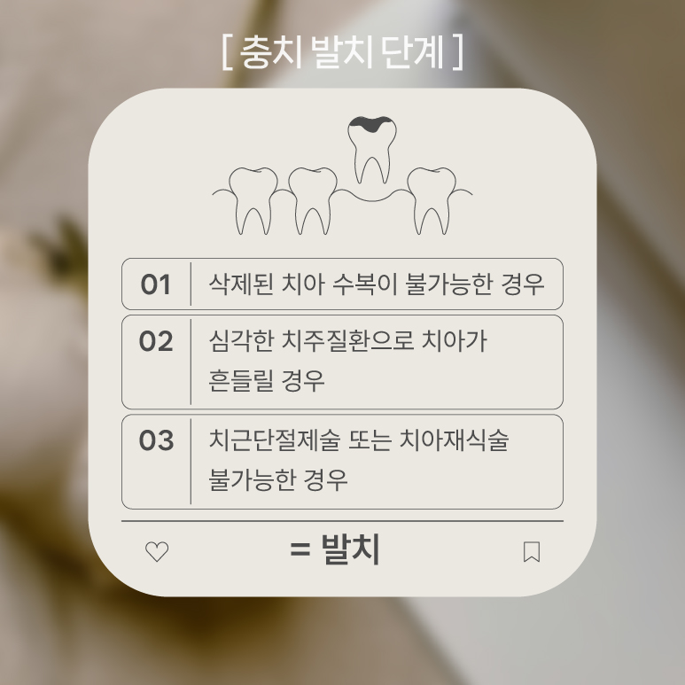 충치 발치해야 하는 이유 (치과 보존과 신경 치료 치근단절제술) 관련 이미지 5