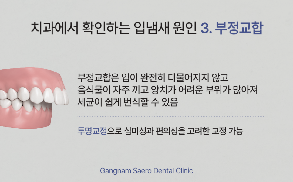 입냄새 치과에서 확인해야 할 몇 가지 (입냄새원인) 관련 이미지 5