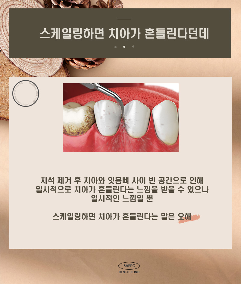 스케일링 오해와 진실 (치아 깎임, 흔들림, 벌어짐, 이시림, 무통스케일링) 관련 이미지 3