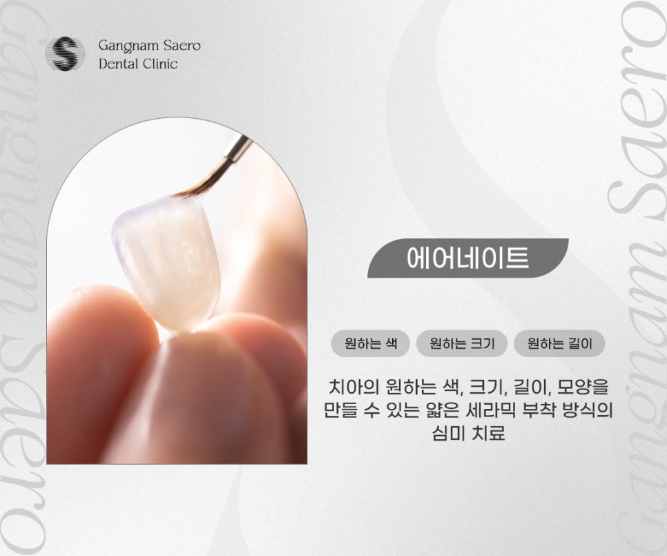 강남새로치과, 역 도보 5분 근처치과 임플란트부터 교정 라미네이트 관련 이미지 6