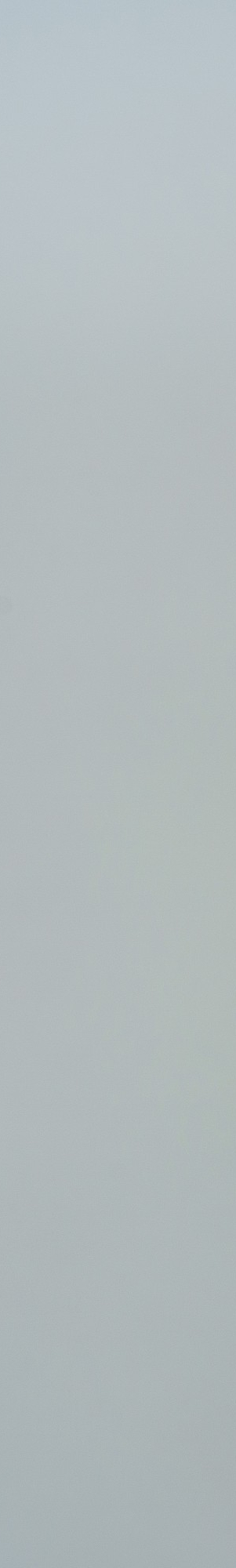 치아교정부작용. 종류와 예방 방법, 교정은 치료 잘 하는 곳에서! 관련 이미지 7