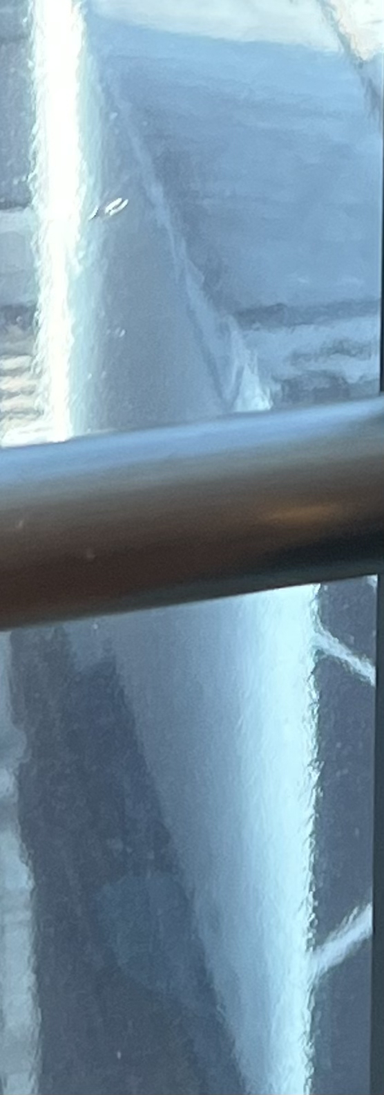 발치 후 교정, 이빨을 뽑지 않는 치료 방법이 있다? 관련 이미지 11