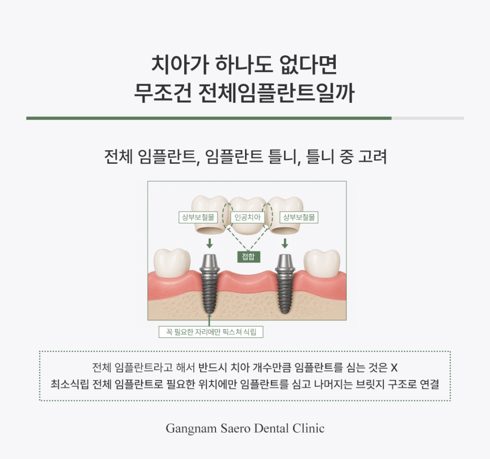 65세이상임플란트, 안전한 임플란트 수술 방법 관련 이미지 6