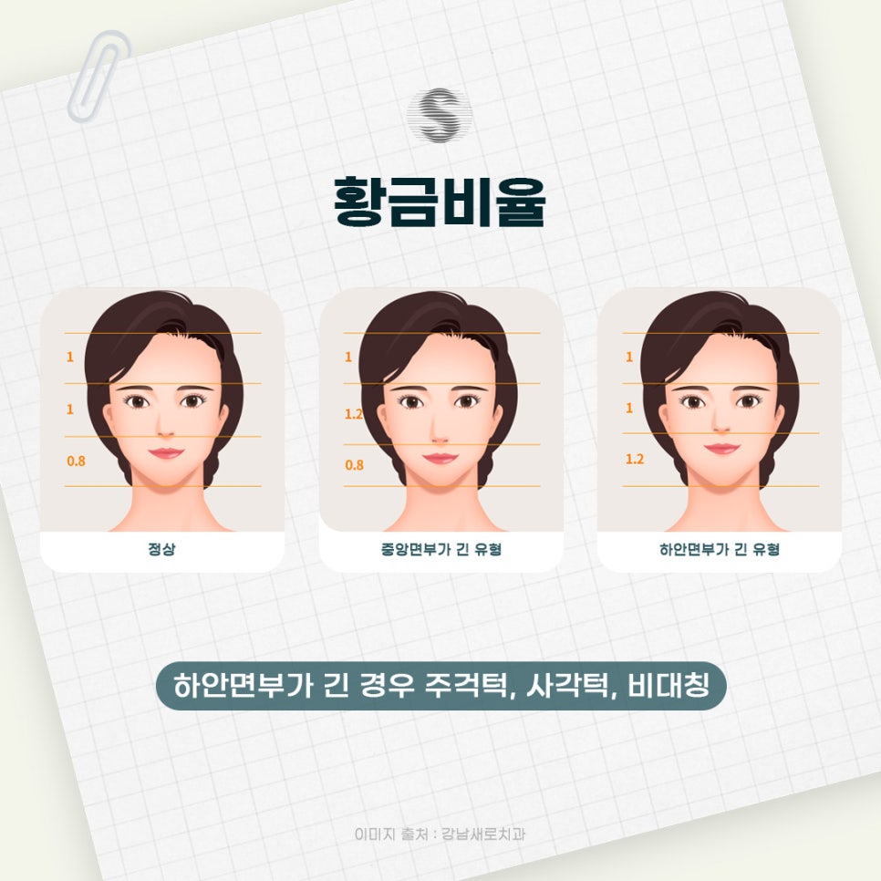 황금보다 빛나는 나의 시절을 위한 황금비율 (비수술양악교정) 관련 이미지 2