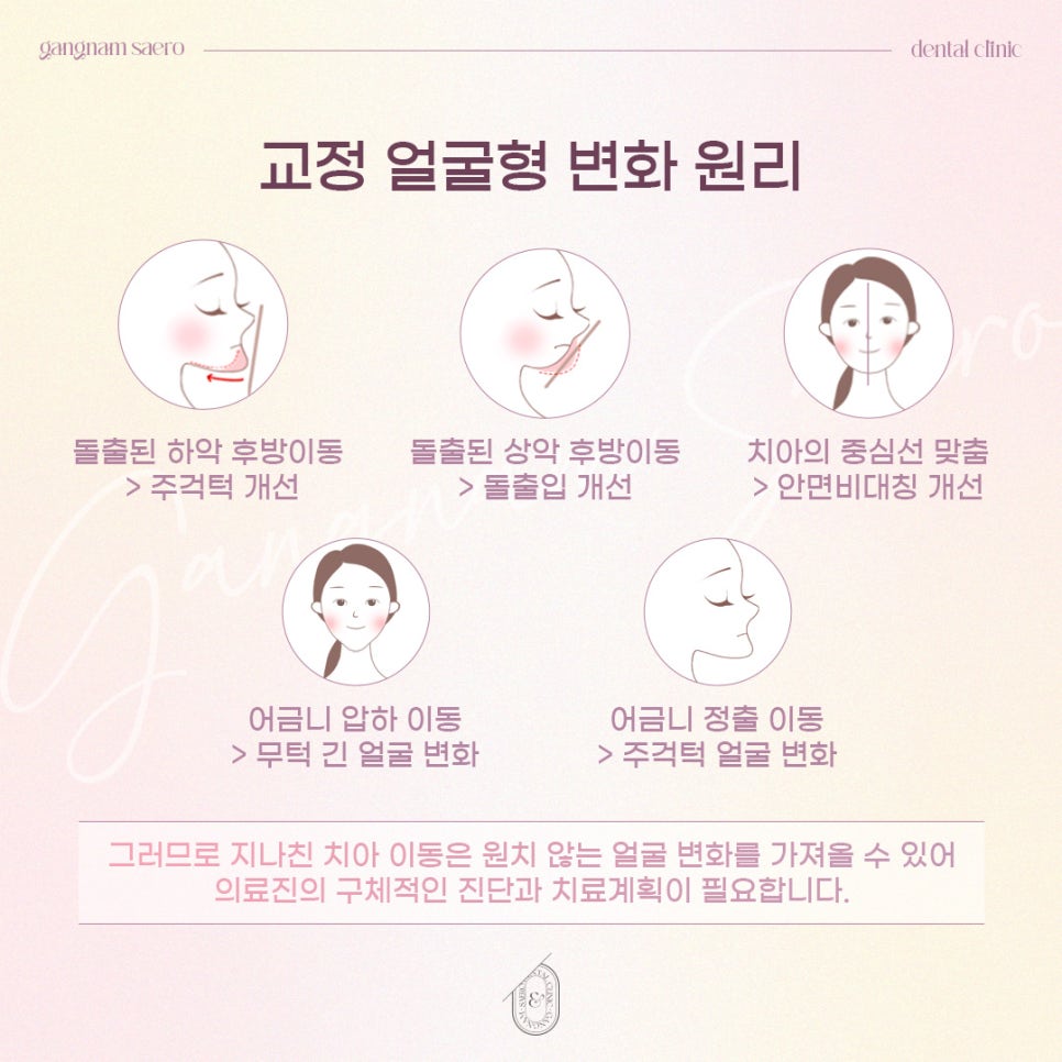 치아 교정으로 얼굴형을 바꿀 수 있나요? (교정얼굴형변화) 관련 이미지 4
