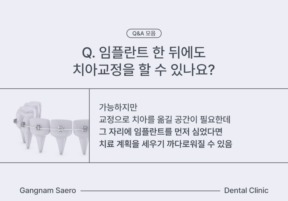임플란트 구체적인 질문 MRI, 골다공증, 치아교정, 충치 Q&A 모음 관련 이미지 4