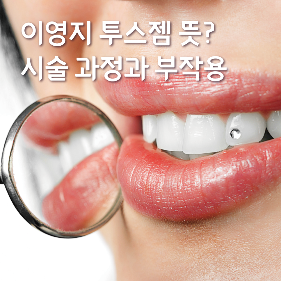 이영지투스젬, 리사투스젬 뜻? 시술 과정과 부작용 관련 이미지 1