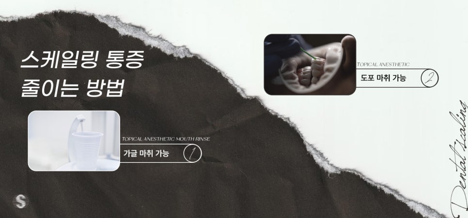 올해 지나기 전에 스케일링 건강보험적용, 놓치지 마세요! (스케일링통증 스케일링비용) 관련 이미지 4