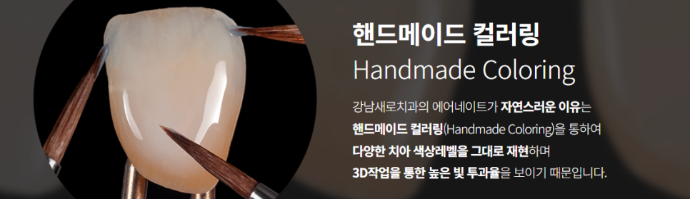 에어네이트의 특별함 (라미네이트 대체 시술) 관련 이미지 6