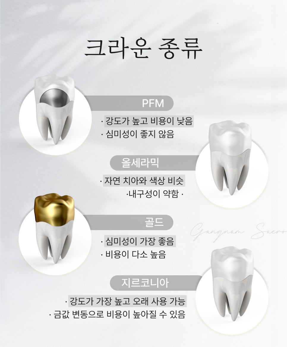 치과 인기 검색어 관련 이미지 4