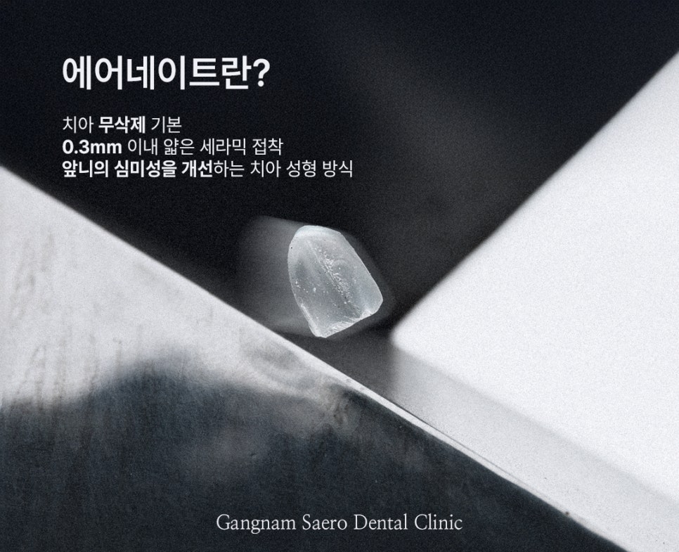 치아 컴플렉스 해결에는 삭제제로라미네이트 에어네이트 (무삭제라미네이트) 관련 이미지 6