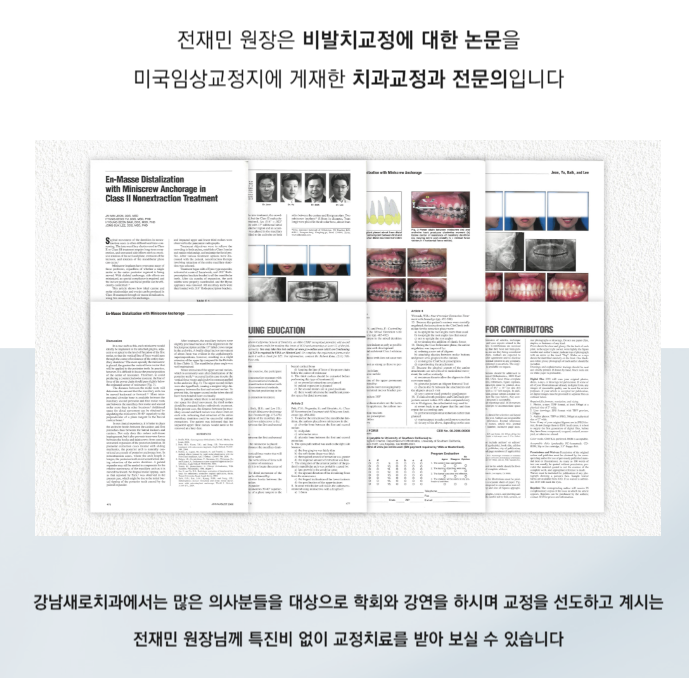 발치교정 과 비발치교정 의 기준은 어떻게 되나요? (비발치교정) 관련 이미지 5
