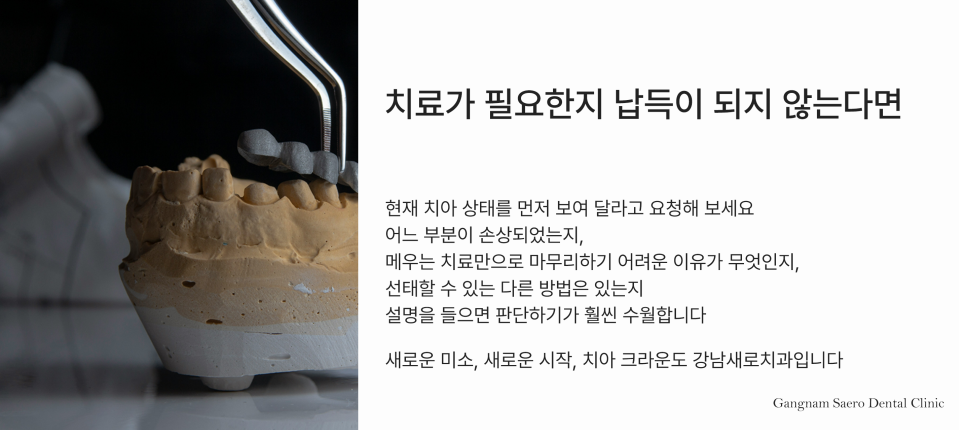 치아크라운, 신경치료 후 꼭 해야 하나요? 종류와 선택 방법까지 관련 이미지 7