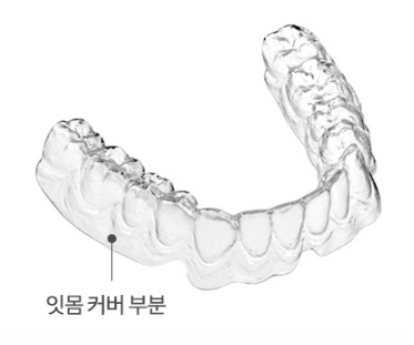 맞춤형 교정치료 [ 인비절라인과 나노라이너 ] [ 강남새로치과 ] 관련 이미지 4