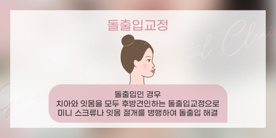 잇몸돌출교정 잇몸성형 수술 비수술 (잇몸돌출) 관련 이미지 5