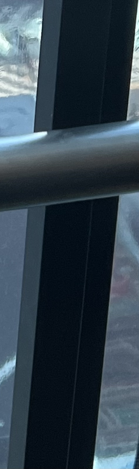 발치 후 교정, 이빨을 뽑지 않는 치료 방법이 있다? 관련 이미지 14