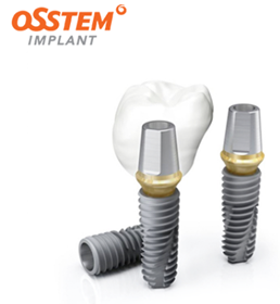 나에게 가장 알맞은 임플란트회사 는? (임플란트종류) 관련 이미지 6