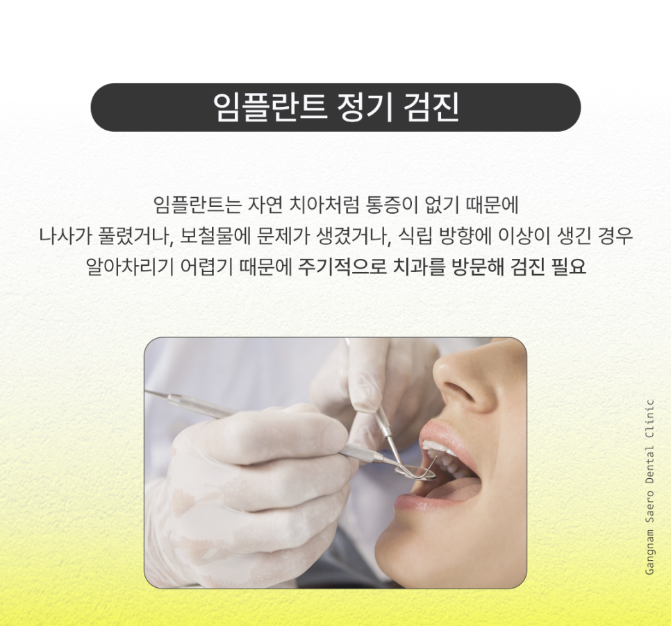 Implant Lifespan: Aren’t Implants Meant to Last a Lifetime? How to Use Them Longer image 3
