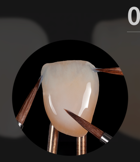 풍자 라미네이트? 치아 삭제 없는 과정으로 관련 이미지 7