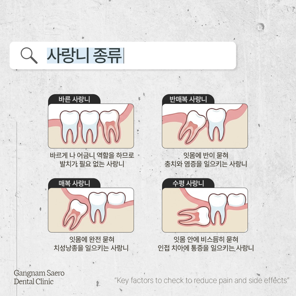 (사랑니발치) 통증과 부작용을 줄이기 위해 확인해야 할 것들 관련 이미지 2