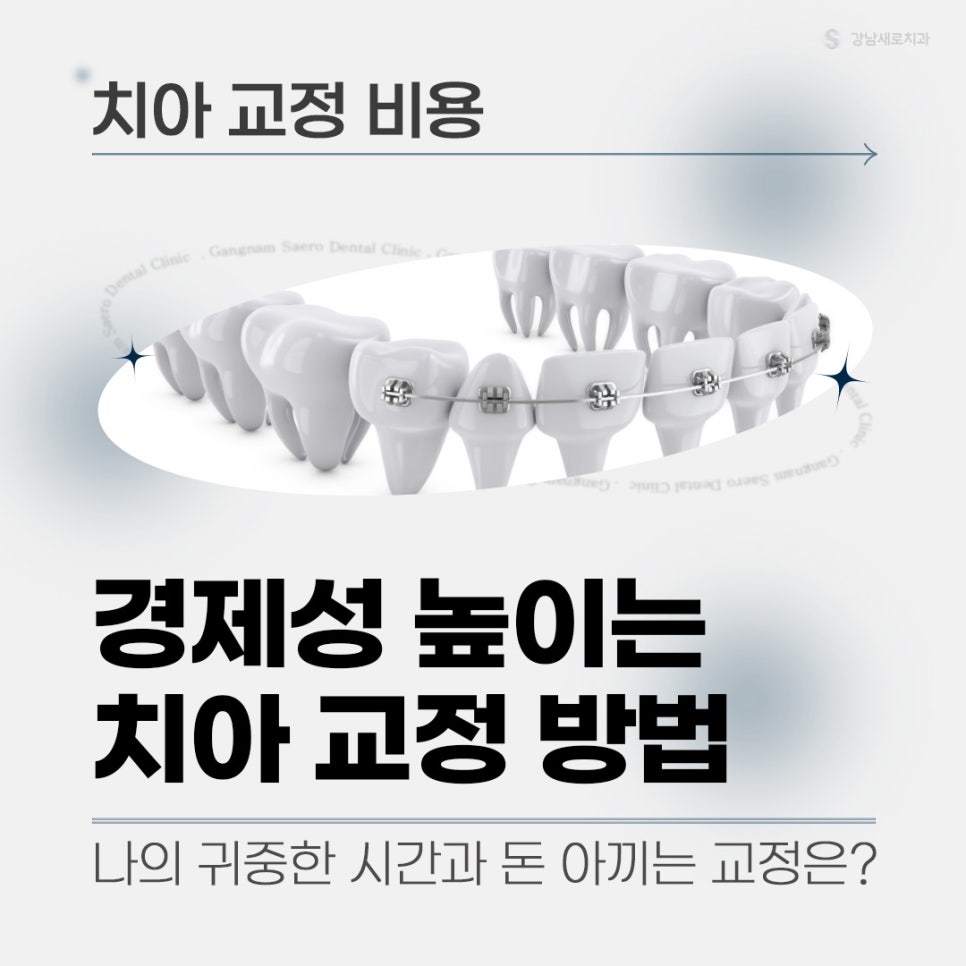 치아교정가격 교정비용비교 교정비용정리 (치아교정비용) 관련 이미지 1