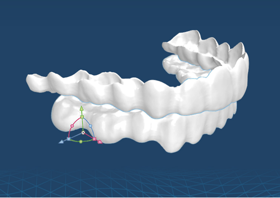 투명교정장치 다시 알아보기 (4) 세라핀 관련 이미지 3