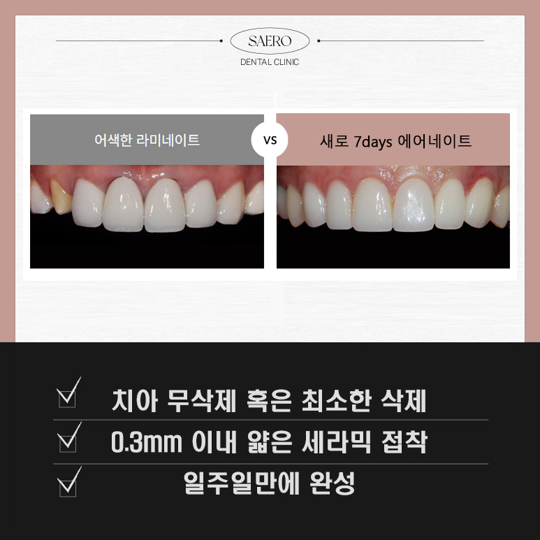 에어네이트의 예술성 (삭제 제로라미네이트) 관련 이미지 4