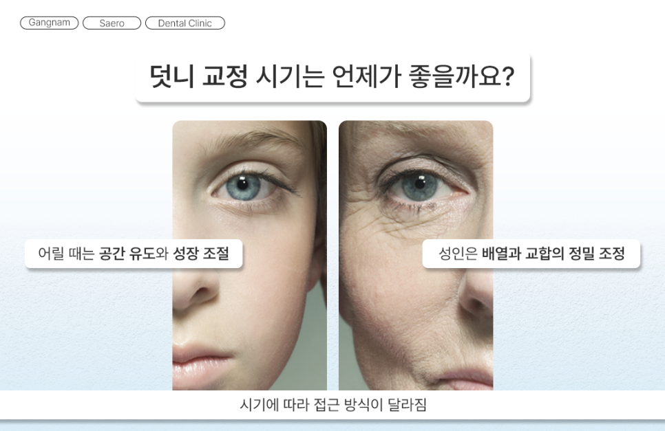 삐뚤어진 치아를 가지런하게 기능과 심미 회복 (덧니교정) 관련 이미지 7
