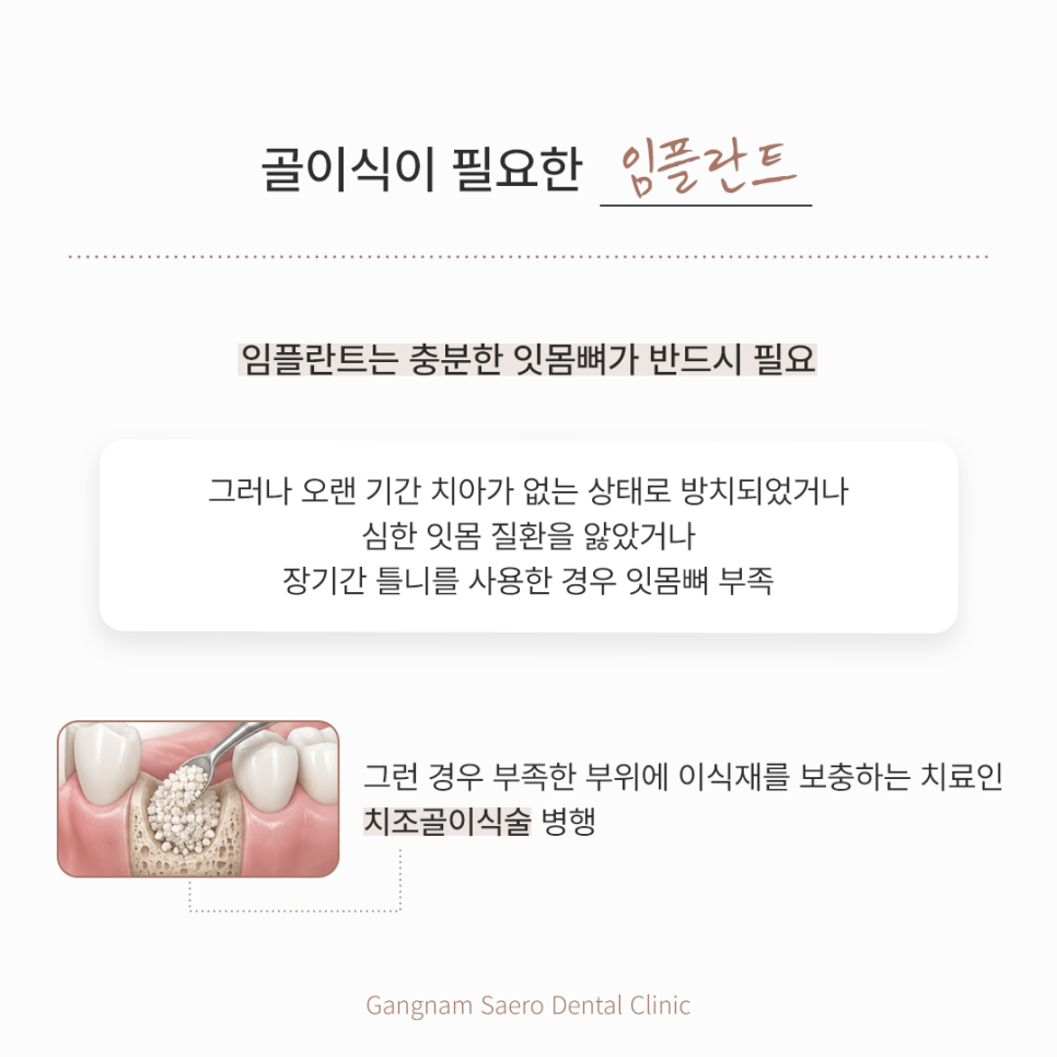 65세임플란트, 5060 부모님에게 드릴 효도 선물 관련 이미지 4