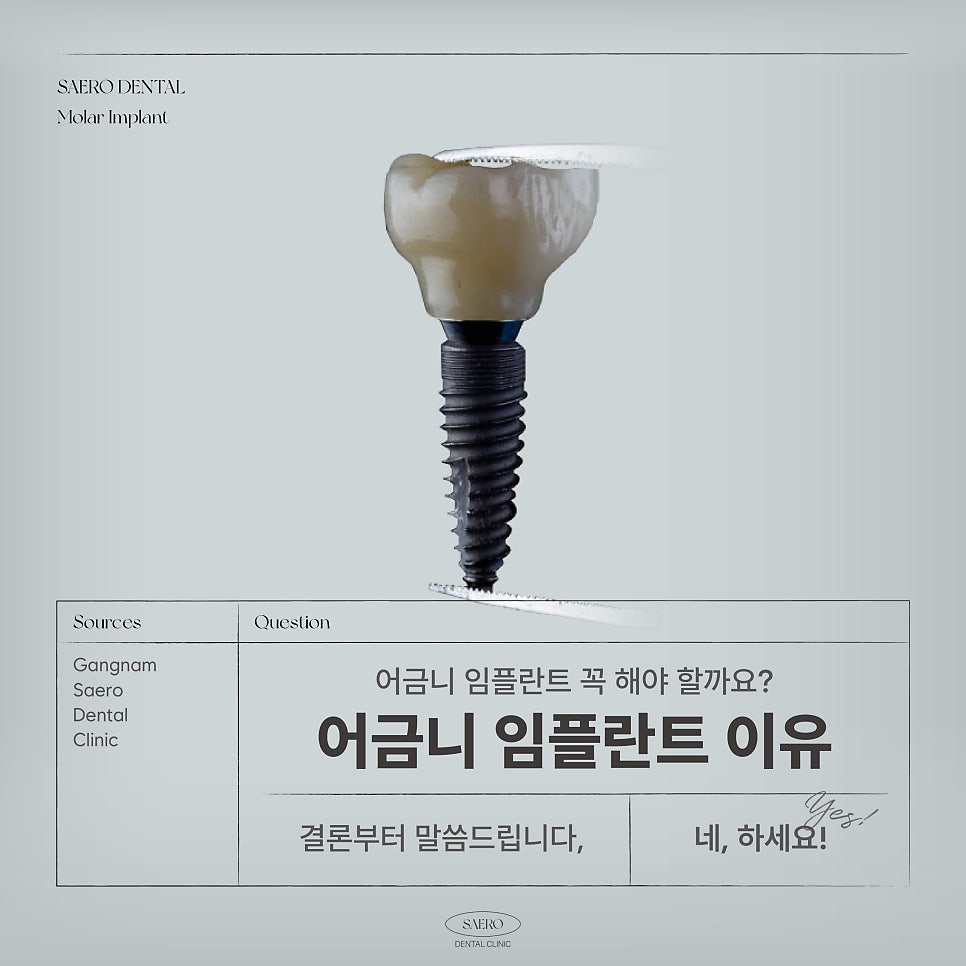 어금니 발치 후 임플란트 해야 하는 이유 (어금니임플란트) 관련 이미지 1