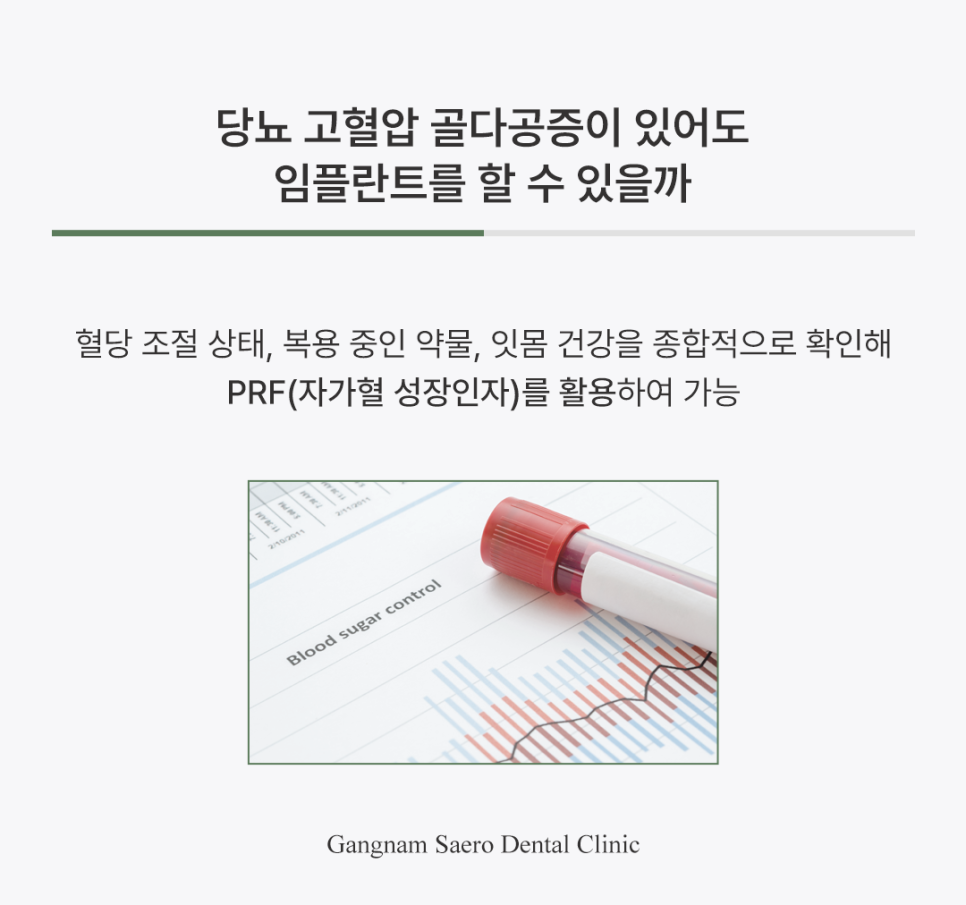 65세이상임플란트, 안전한 임플란트 수술 방법 관련 이미지 4