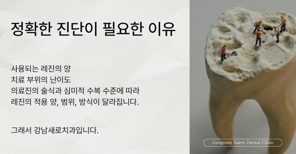 (치아레진 으로 치료하는) 치아크랙 치아깨짐 치아벌어짐 치아파절 치아모양 관련 이미지 6