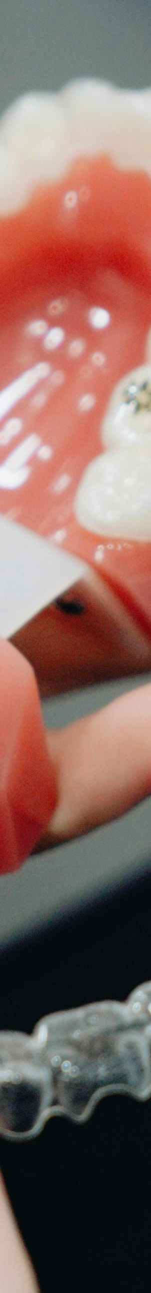 음료수 치아 건강 구강 건강을 지키기 위해서는 어떻게 해야할까요? 관련 이미지 12