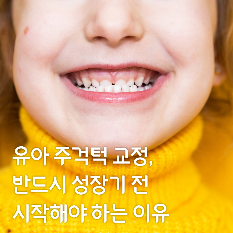 어린이주걱턱교정, 성장기전 빠른 시일내에 진행해야 하는 이유? 관련 이미지 1