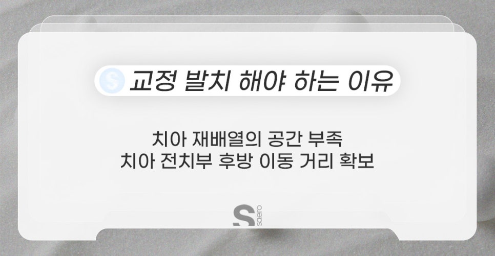 치아교정할 때 발치해야 하는 이유 (비발치중심 치아교정) 관련 이미지 2