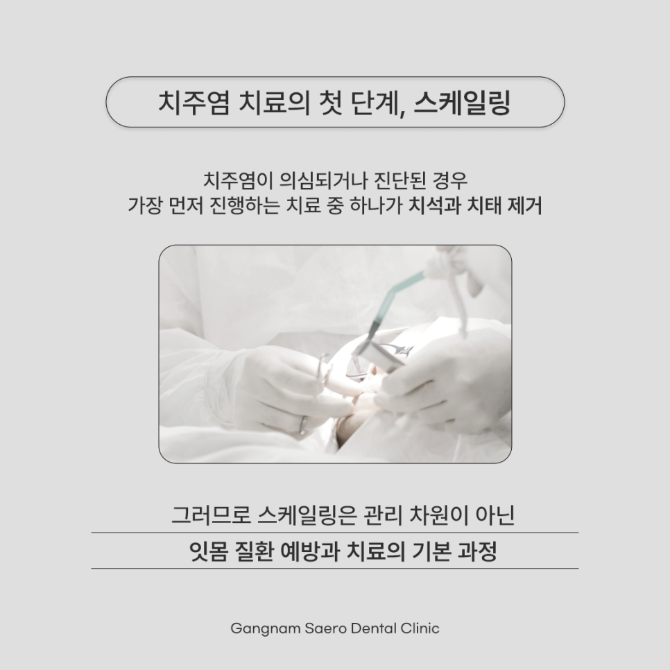 Scaling Guide for Office Workers (Scaling Time, Scaling Side Effects, Scaling Cost) image 4